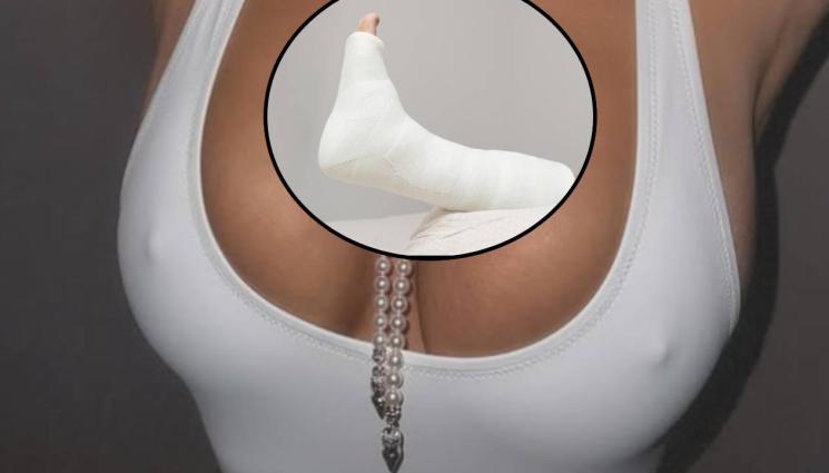 d - БОЛЕЗНЕН ИНЦИДЕНТ: Любимка на милиони счупи крак (СНИМКИ)