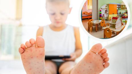 коксаки вирус градина