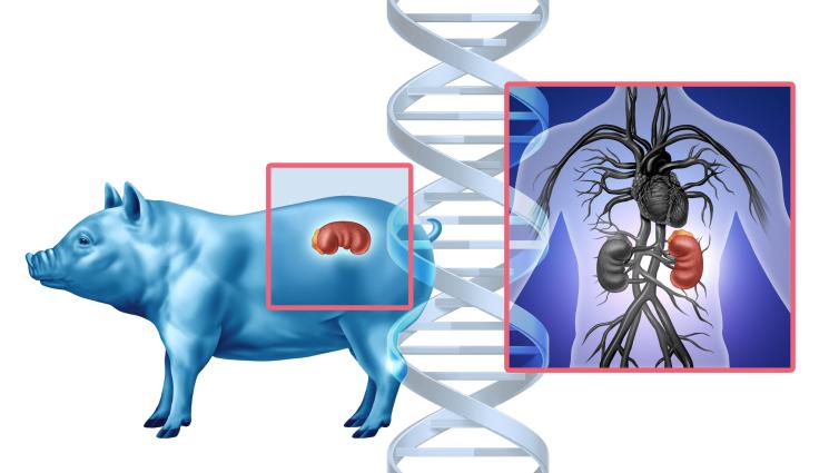 трансплантация бъбрек свински прасе - ЖИВОТОСПАСЯВАЩО: Трансплантираха ГМО бъбрек от прасе на жена!