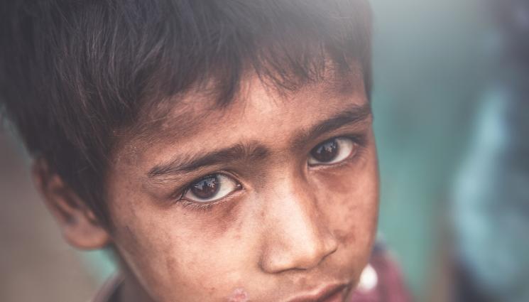 глад дете гладно - Безпрецедентна хуманитарна криза: Над 15 милиона деца гладуват в разкъсвана от война страна