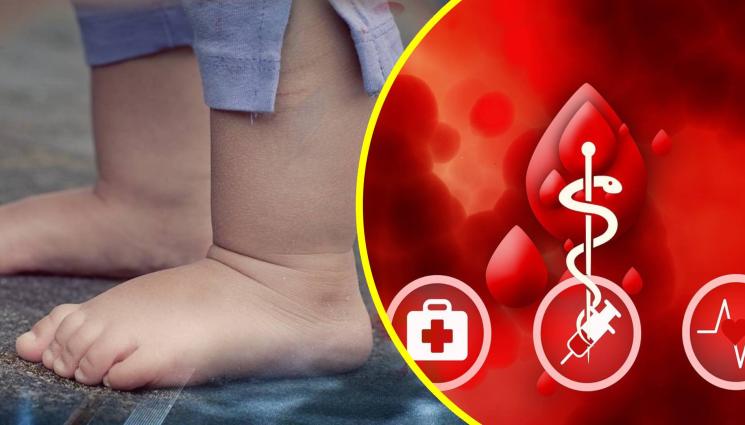 кръв дете - АКО МОЖЕМ, ДА ПОМОГНЕМ: Дечица се нуждаят спешно от кръв!
