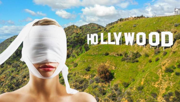 Холивуд пластични операции - Тези звезди казаха