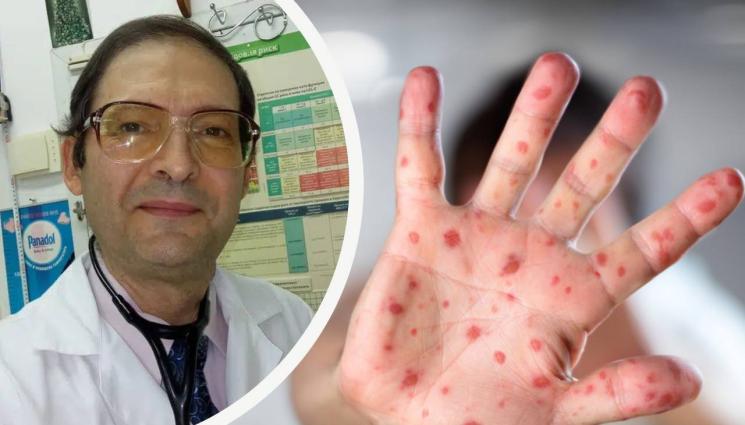 Костадин Сотиров - НЕ НИ СТИГА ГРИПЪТ: Задава се бум на варицела!