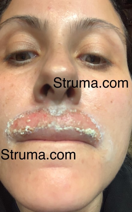 Ана Стойчева