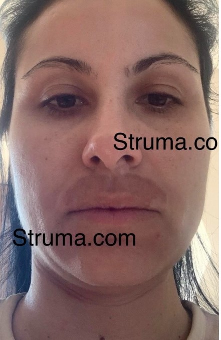 Ана Стойчева