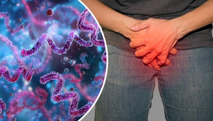 сифилис венерическа болест срамна болест - ЦЕНАТА НА УДОВОЛСТВИЕТО: Скок на заразените със сифилис!