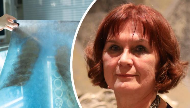 Елена Георгиева - Доц. Елена Георгиева, шеф на Клиниката по детска пневмология и фтизиатрия към УМБАЛ „Св. Иван Рилски“, пред ЗДРАВЕ с Телеграф: Туберкулозата се възражда