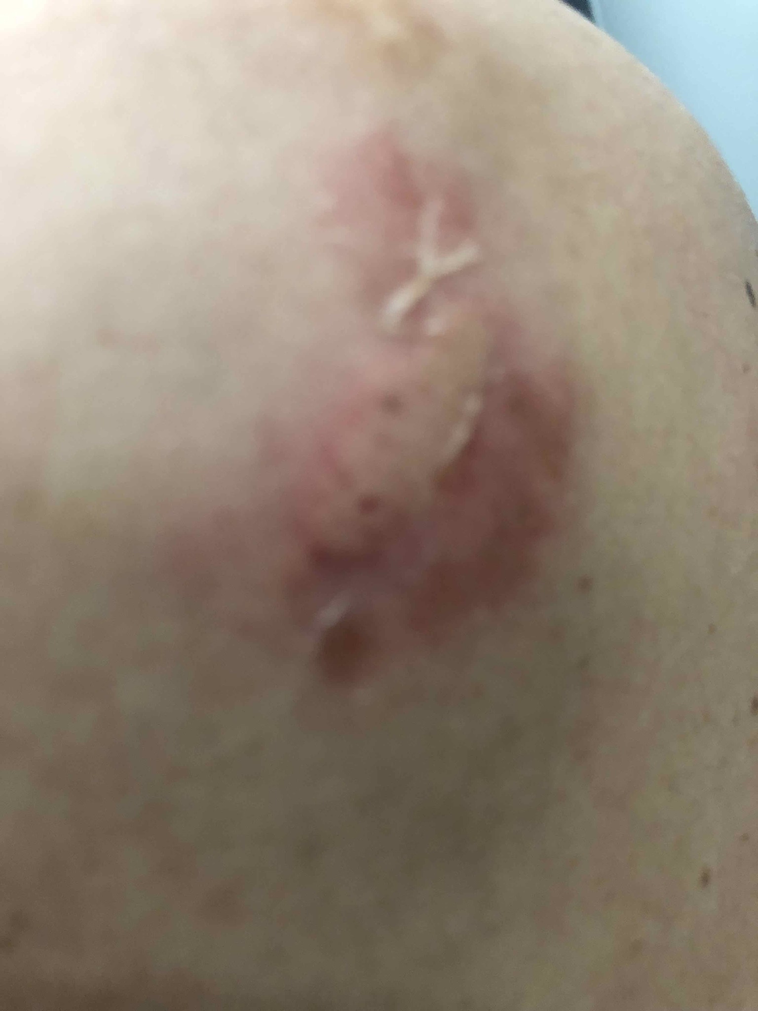 Жоро Игнатов