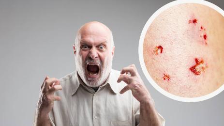 ядосан мъж зъби