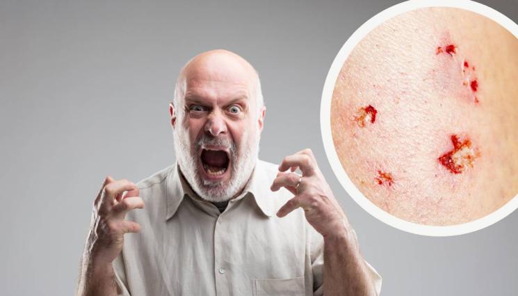 ядосан мъж зъби - ОГОЛИ ЗЪБИ КАТО ПИТБУЛ: Мъж захапа жена си!