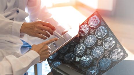 мозък лекар изследване снимка