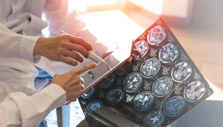 мозък лекар изследване снимка