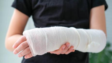 счупена ръка