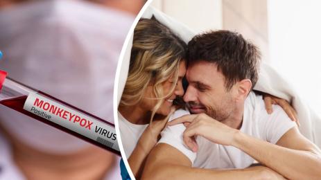 маймунска шарка трипер