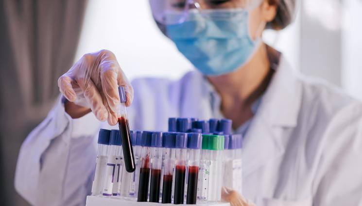 кръв проба - УНИКАЛНО: Откриха съвсем нова кръвна група!