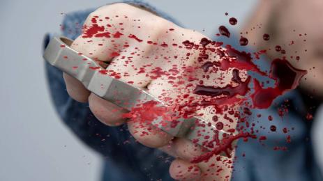 метален бокс побой удар