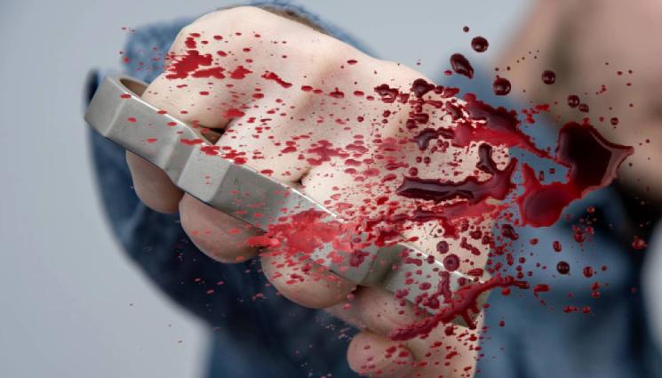 метален бокс побой удар - БРУТАЛНИ КАДРИ: Тийнейджър с бокс в ръката нокаутира дете! (ВИДЕО)