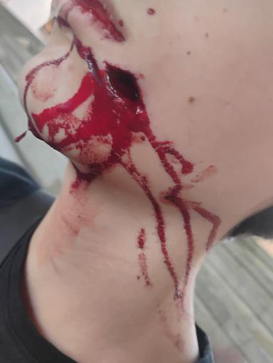 рана метален бокс