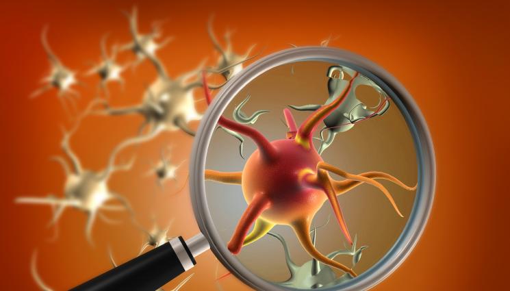 вирус - СТРАШЕН КРАЙ: Мъж почина от изключително рядък вирус