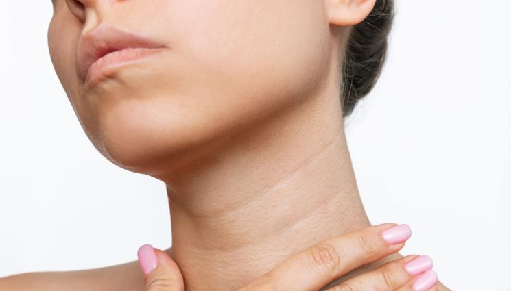 шия - ПРАКТИЧНИ СЪВЕТИ: Как да замажем пръстените на Венера