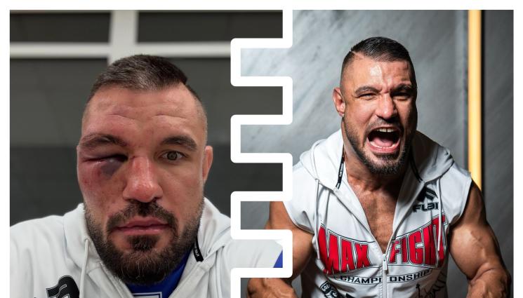 Георги Валентинов - Георги Валентинов се извини на съперника си за отхапаново ухо