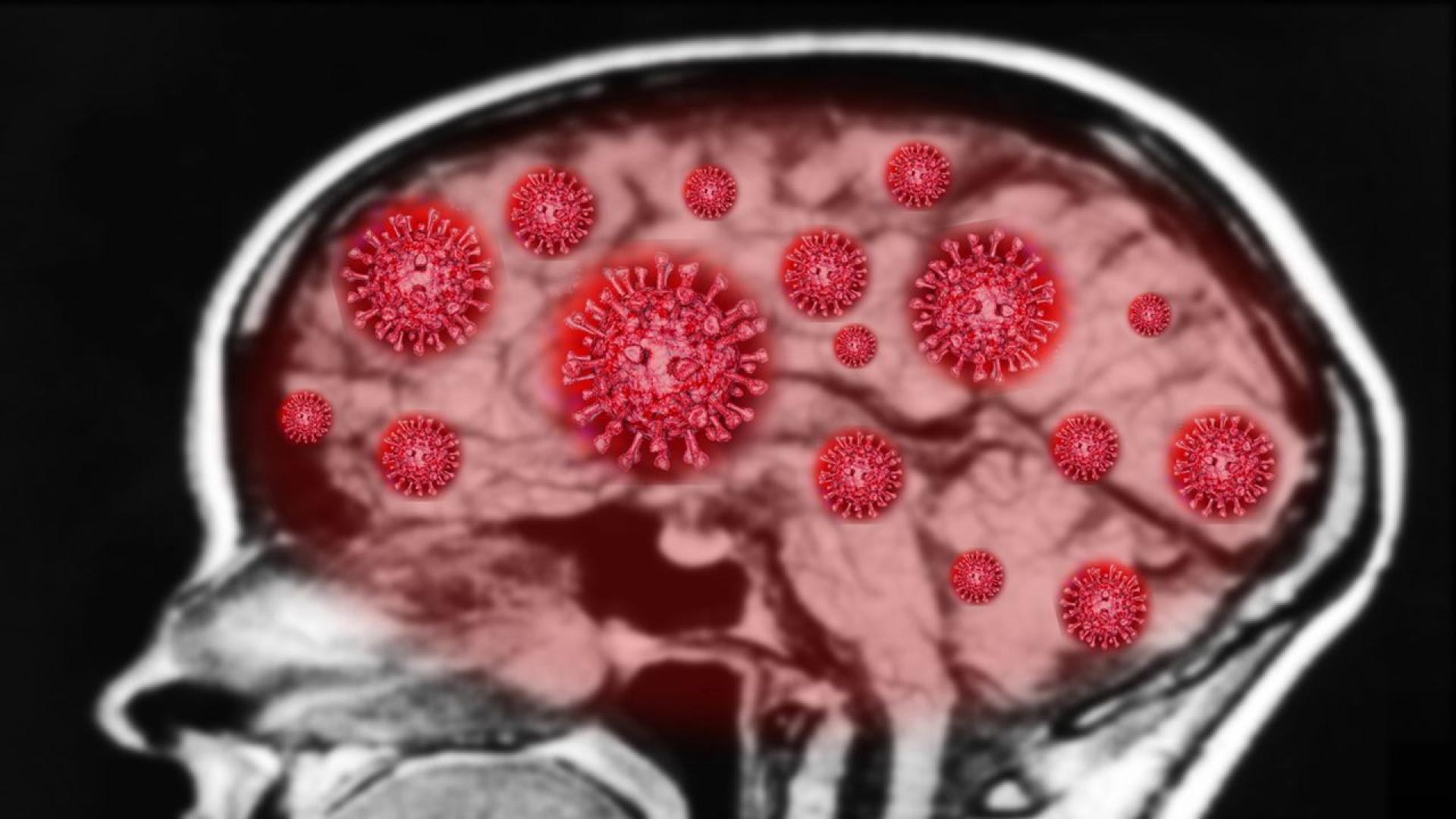 Пандемията от COVID 19 е значително ускорила процеса на стареене на