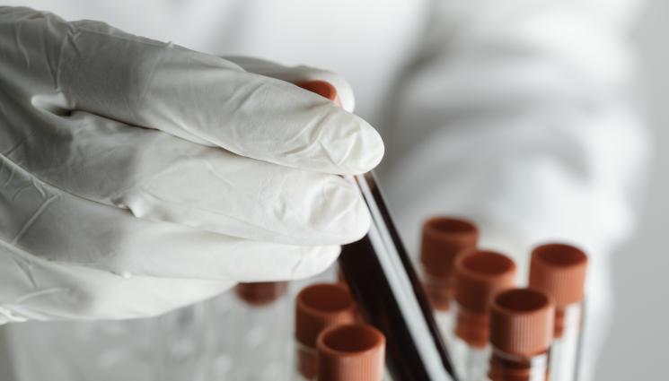 кръв - КАПКА ПО КАПКА: Вампирясала даскалка точи кръвта на учениците си! (ВИДЕО)