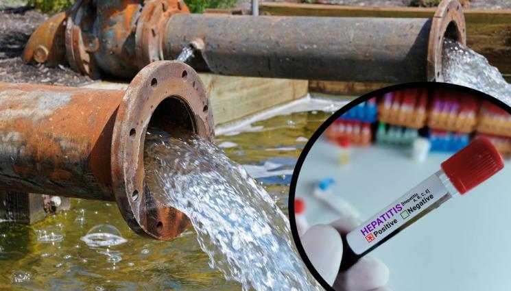 хепатит - ПРИ ИЗСЛЕДВАНЕ НА КАНАЛИТЕ: Хванаха хепатит в отпадните води
