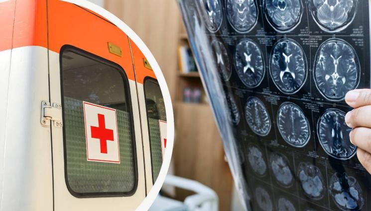 инсулт - НА ЖИВО: Министър получи инсулт в ефир