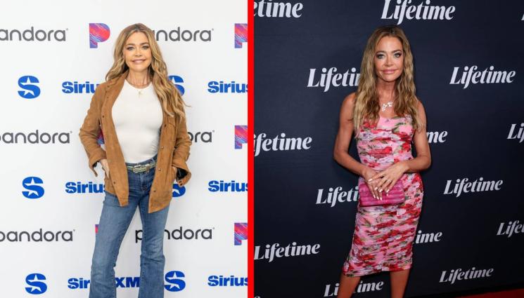 Дениз Ричардс - КАКВО СЕ СЛУЧВА С ДЕНИЗ РИЧАРДС? Синина под окото и разрязана брадичка!