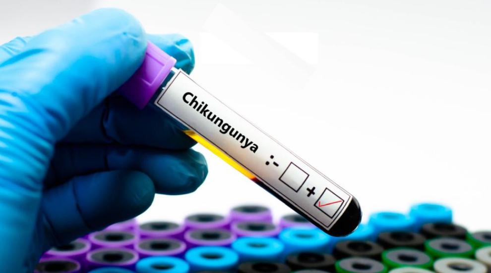 Нов случай на треска чикунгуня у нас