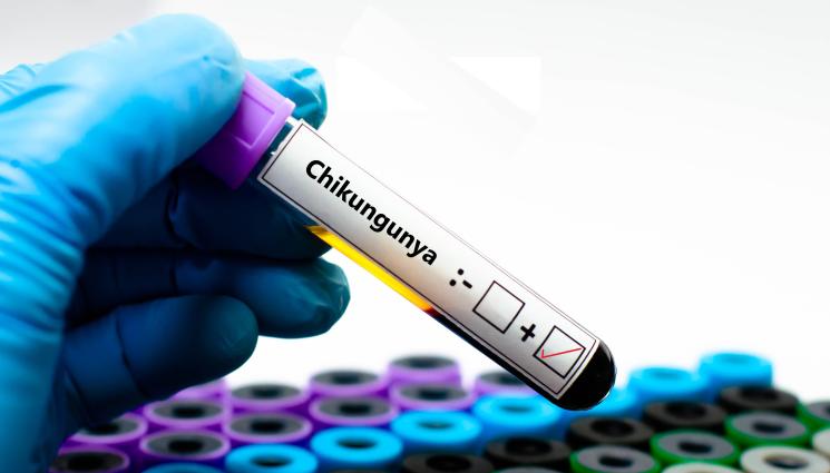 чикунгуня - ЗДРАВЕ с Телеграф: Тропическа треска удря ставите