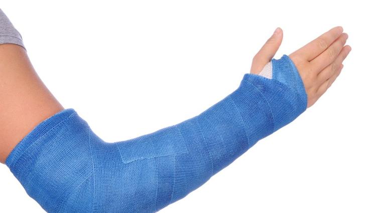 гипсирана ръка - Хванаха младеж, скрил метамфетамин в гипса на ръката си