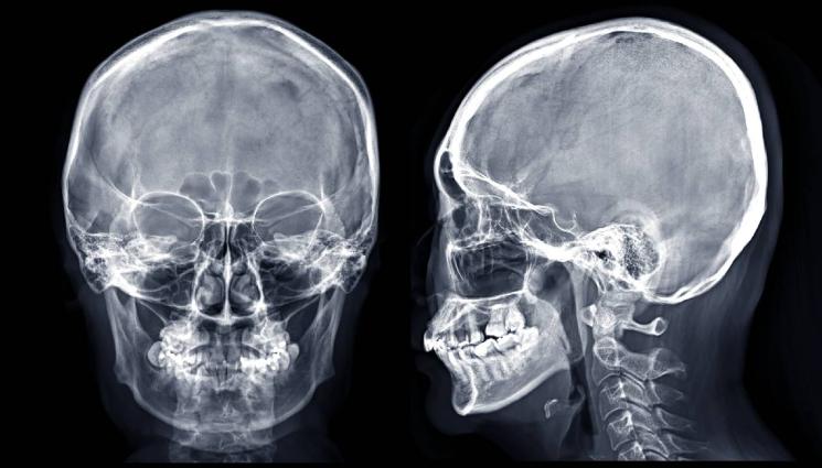 d - ШОКИРАЩО: Имплант прочете мислите на човек!