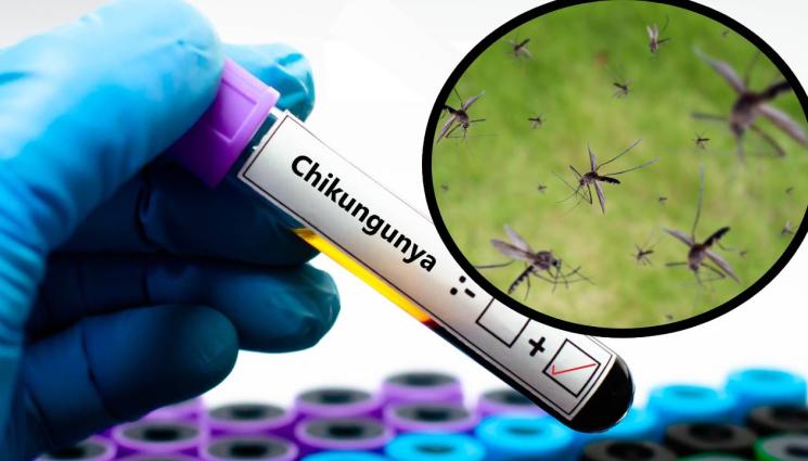 чикунгуня - ГЛОБАЛНА ЕПИДЕМИЧНА ТРЕВОГА: Смъртоносният вирус, пренасян от комари, върлува в Китай и вече стига до Европа!