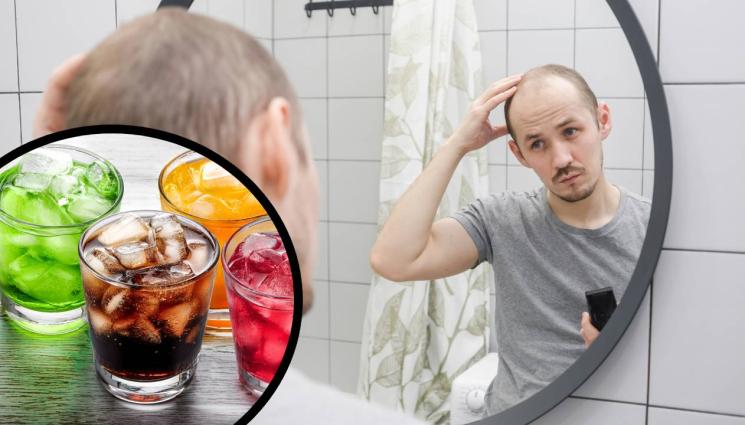 плешив - ИЗНЕНАДА: Ето от кои напитки може да оплешивеем!