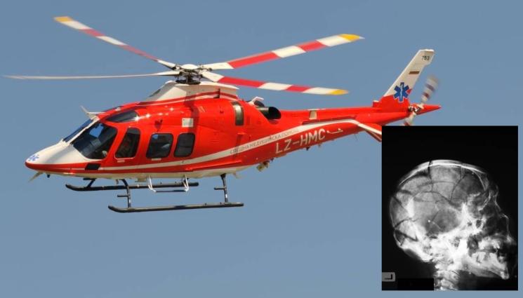 д - Камък счупи черепа на шофьор, транспортират го с хеликоптер до София