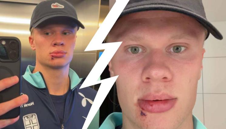 Ерлинг Холанд - Намери се какво да спре Ерлинг Холанд