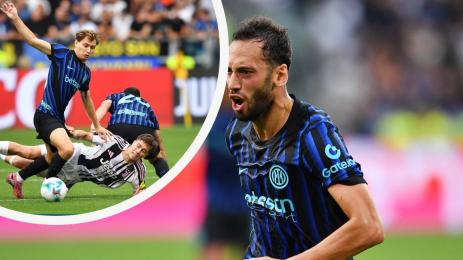 Ювентус Интер