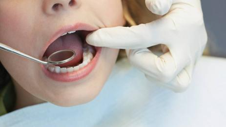 дете зъболекар