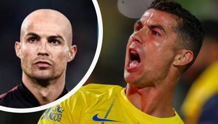 Кристиано Роналдо - Най-големият ужас за Роналдо - оплешивяването