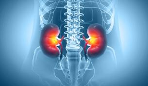 Рядък медицински случай: Мъж разви камъни в бъбреците от хранителни добавки