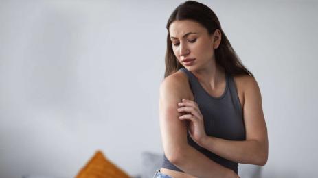 псориазиса