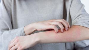 кожни проблеми