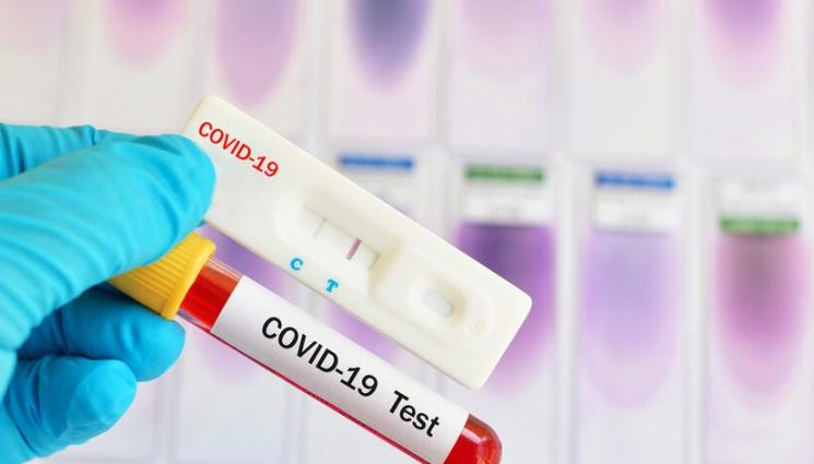 Ковид тест - ВСЕ ПО-ЧЕСТО: Всеки 7-и тест за COVID - положителен