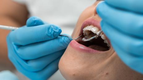 Зъбни импланти