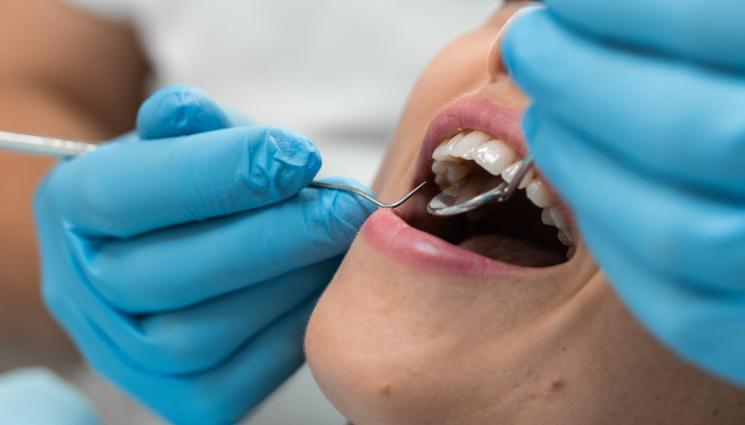 Зъбни импланти - Имплантите – риск или инвестиция за цял живот?