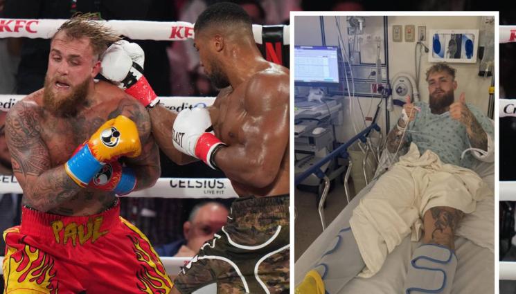 Джейк Пол - Сложиха пластини и махнаха зъби на Джейк Пол