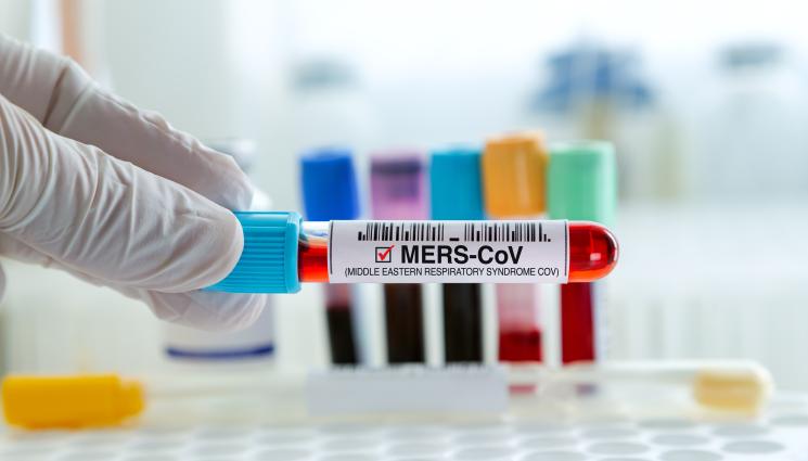 Mers Мерс - СЛЕД ГОДИНИ ЗАТИШИЕ: Смъртоносният вирус MERS се завърна в Европа!