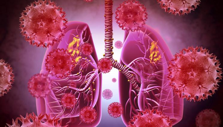 Мерс - ЗА ПЪРВИ ПЪТ СЛЕД COVID-19: СЗО издаде предупреждение заради MERS!